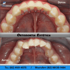 isadora-orto-2-oral-300x300